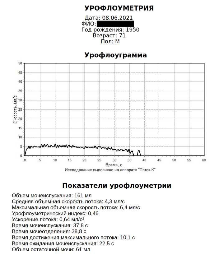 Результат урофлоуметрії з проблемою