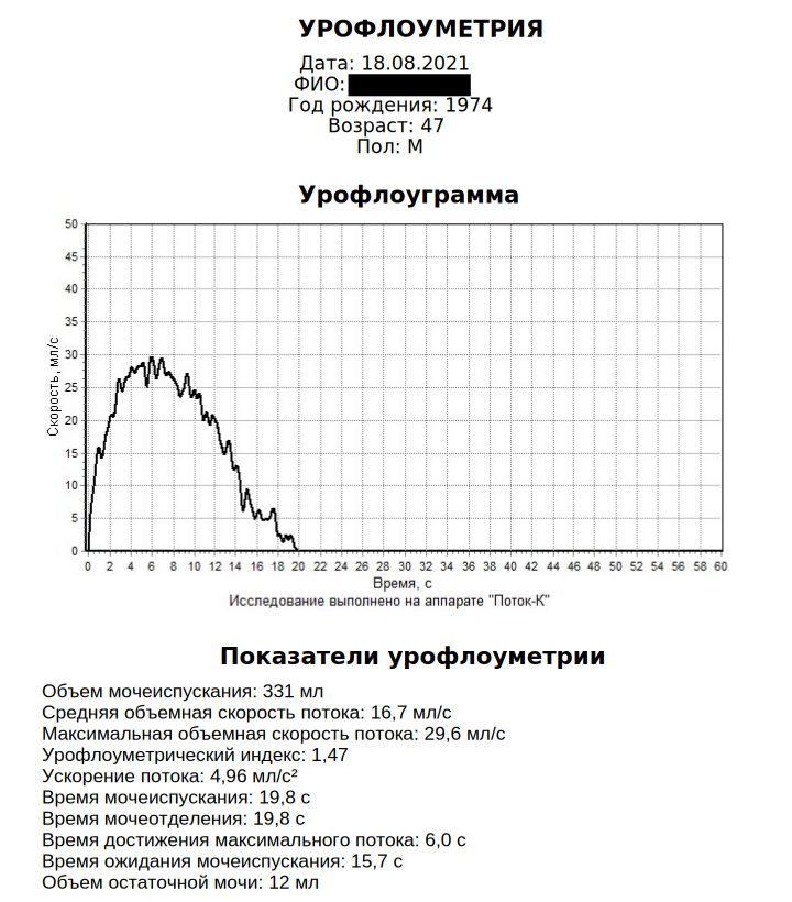 Результат нормальної урофлоуметрії